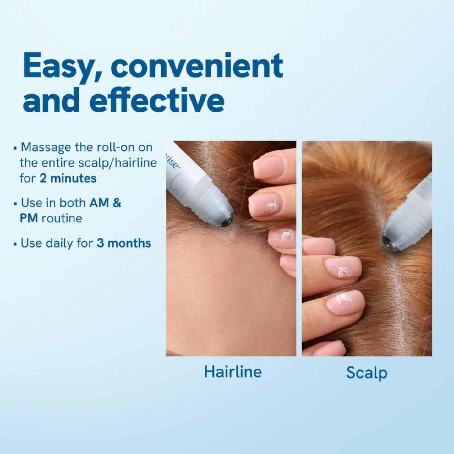 RootRush™ Precision Hair Regrowth Serum Roll-On