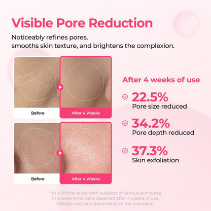 PoreFade™ Set | Shrinks Pores & Fades Blemish